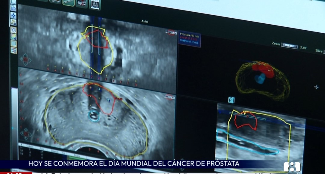 11 de junio, Día Mundial contra el Cáncer de Próstata