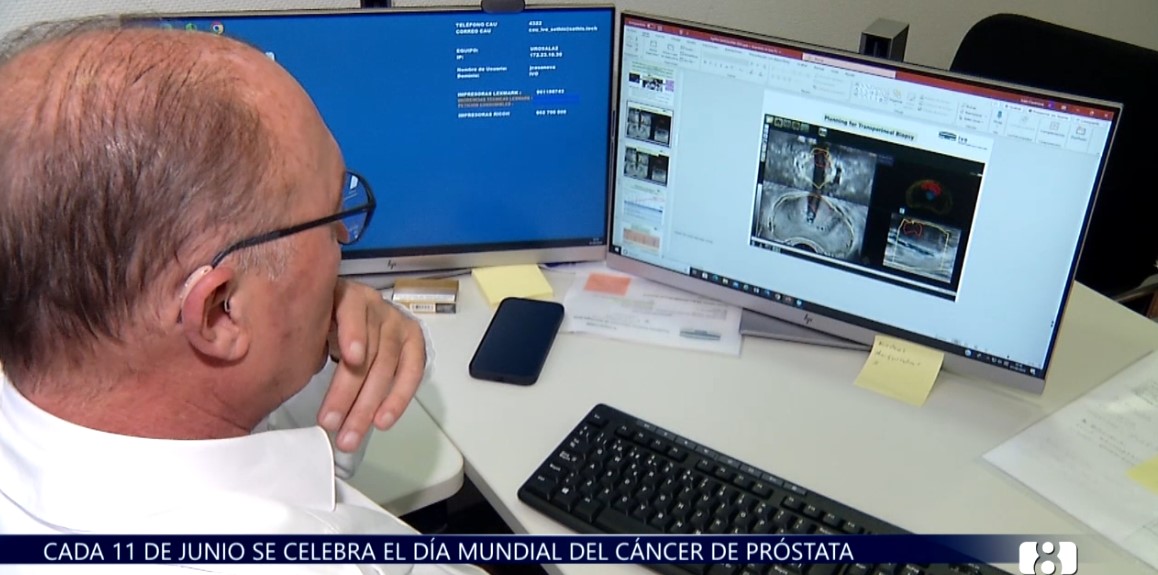 Claves para la detección temprana y el tratamiento integral del cáncer de próstata