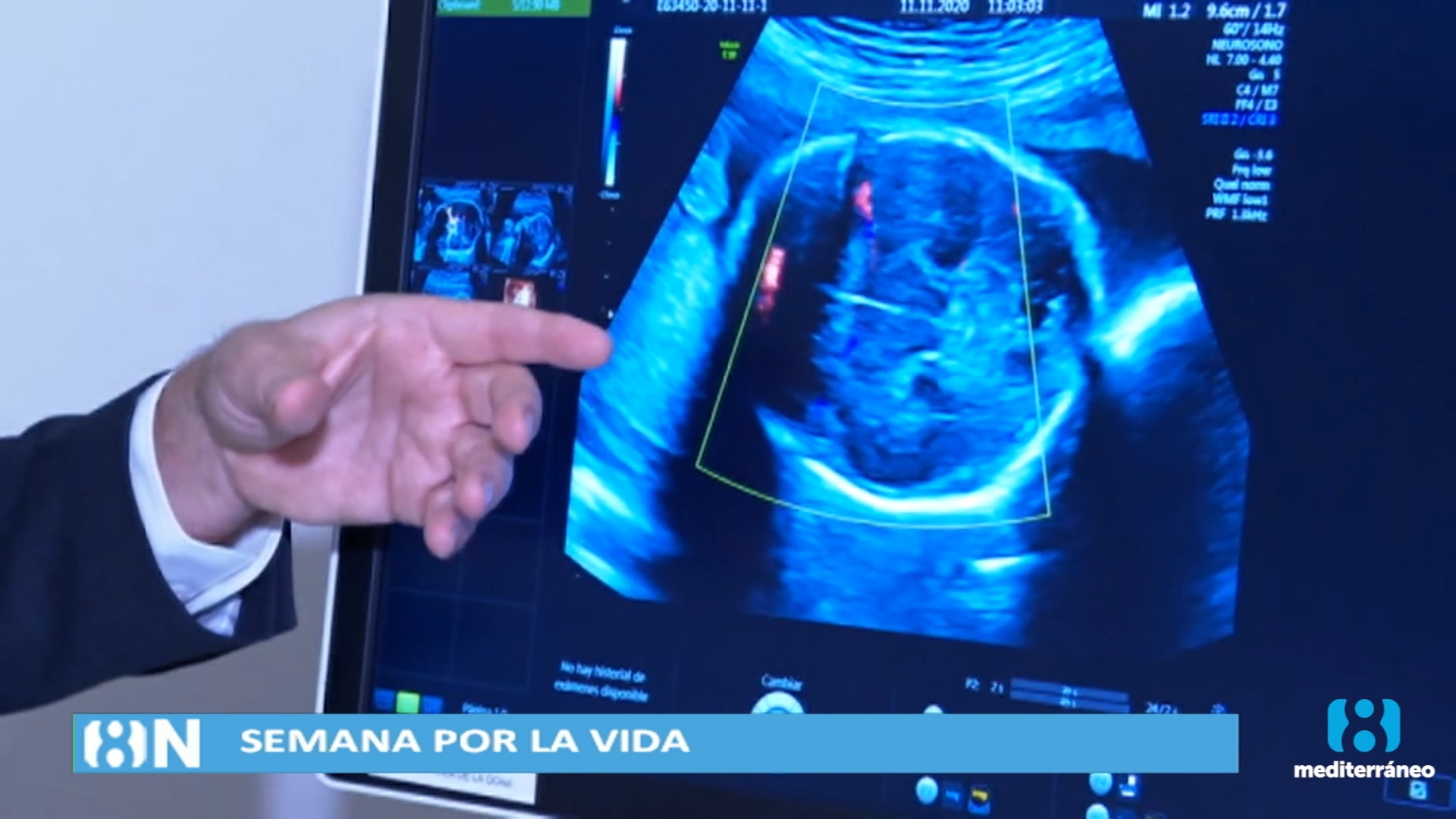 Las asociaciones provida defienden la objeción de conciencia de los médicos ante el aborto