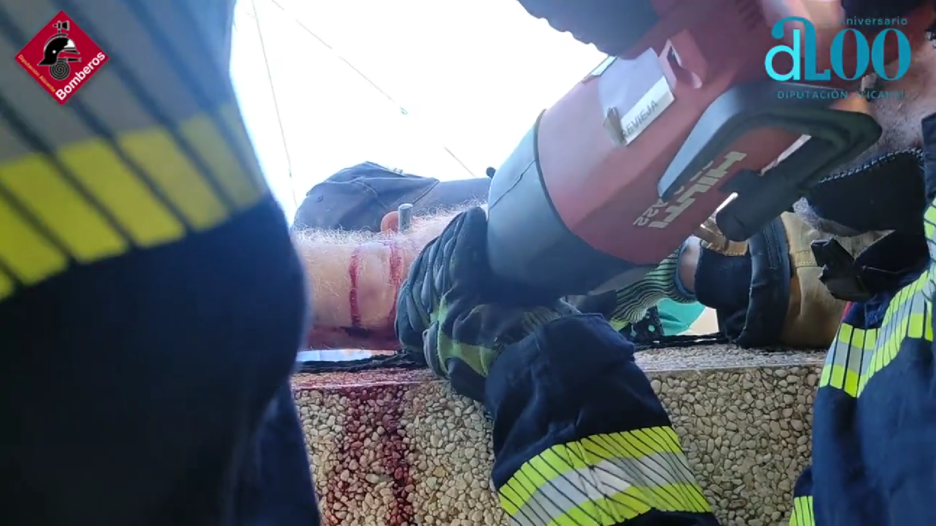 Herido en Torrevieja al atravesarle un hierro de un muro el brazo